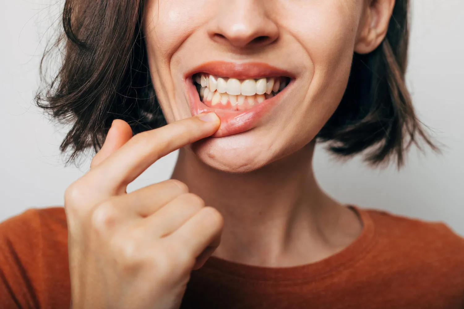 blog sangrado de encias sonreir clinica dental
